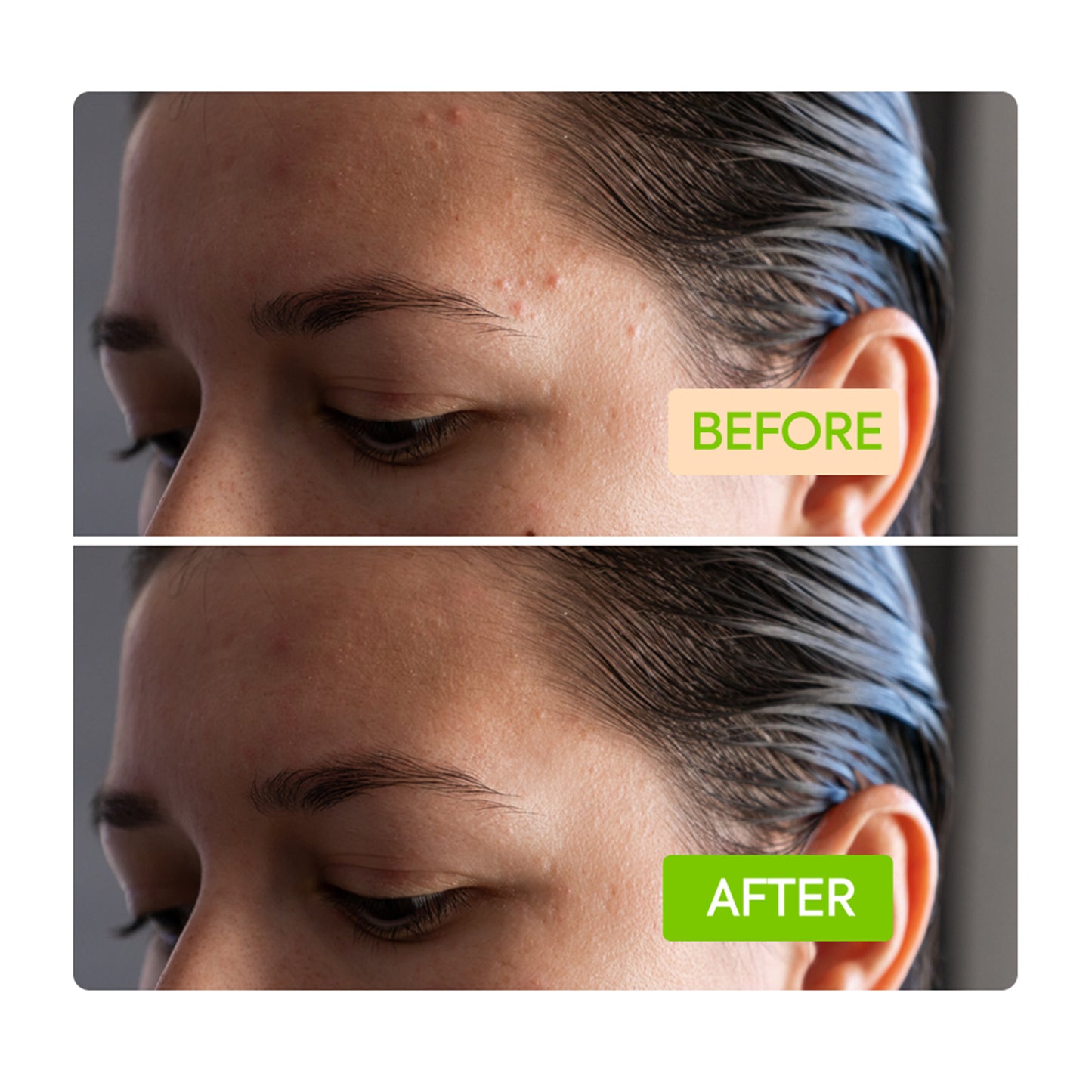 IYKYK Skin Goals Kit - Image 5