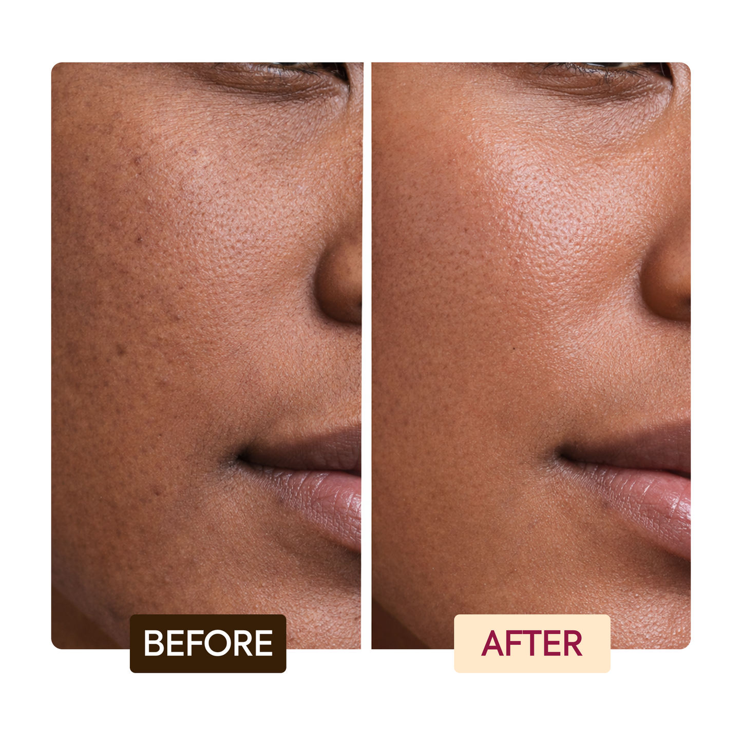 Makari Even Tone Kit - Image 11