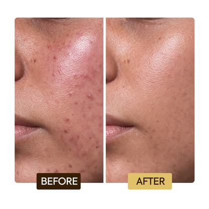 Skin Repairing & Clarifying Serum - Image 5