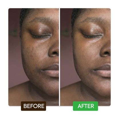 Kojic & Azelaic Brightening Serum - Image 8