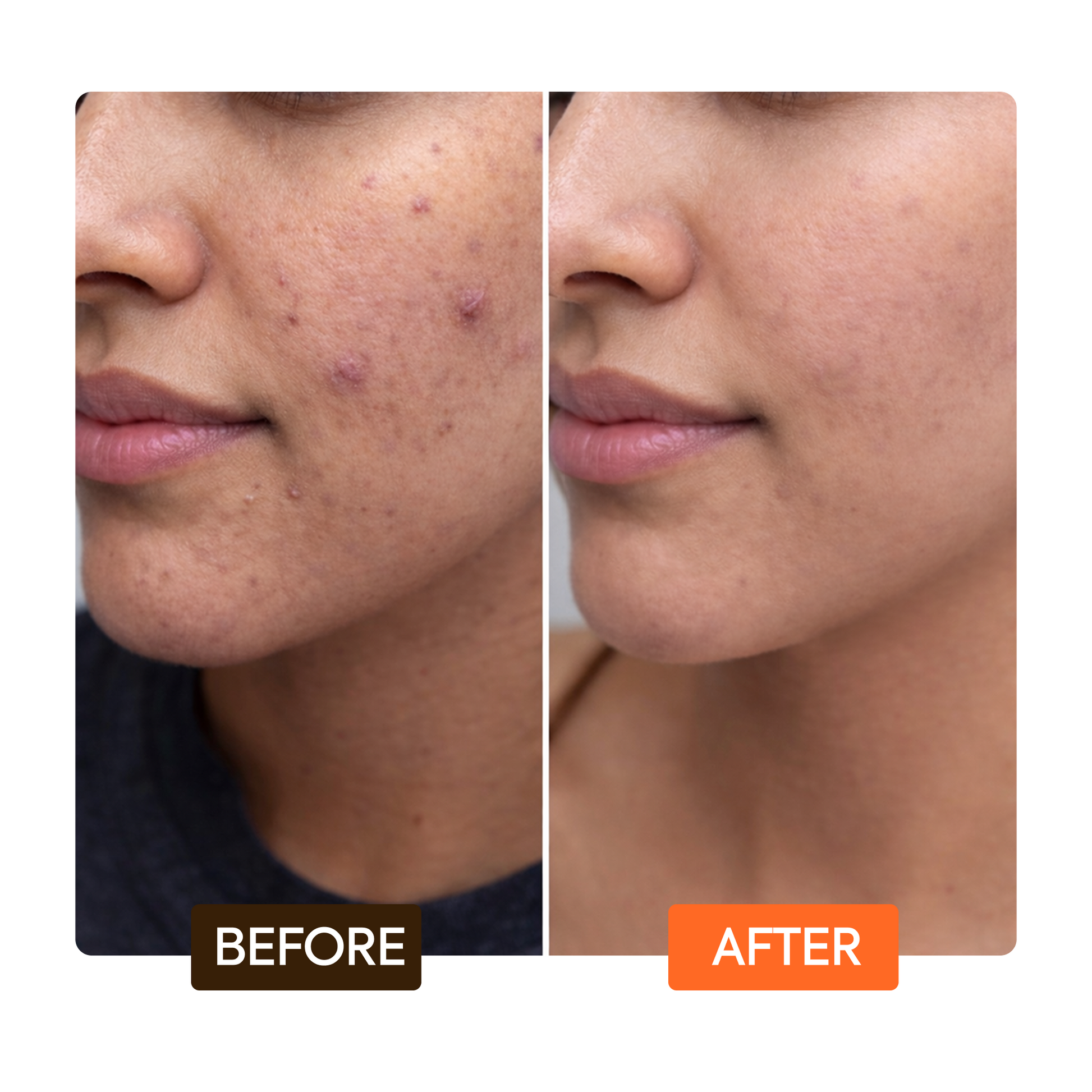 Carotonic Extreme Glow Renewing Face Serum - Image 5