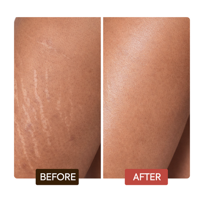 Intense Extreme Glow Rejuvenating Body Lotion - Image 5