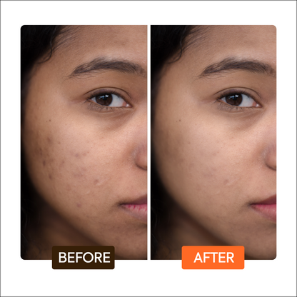 Extreme Argan & Carrot Oil Tone Boosting Cream - Image 6