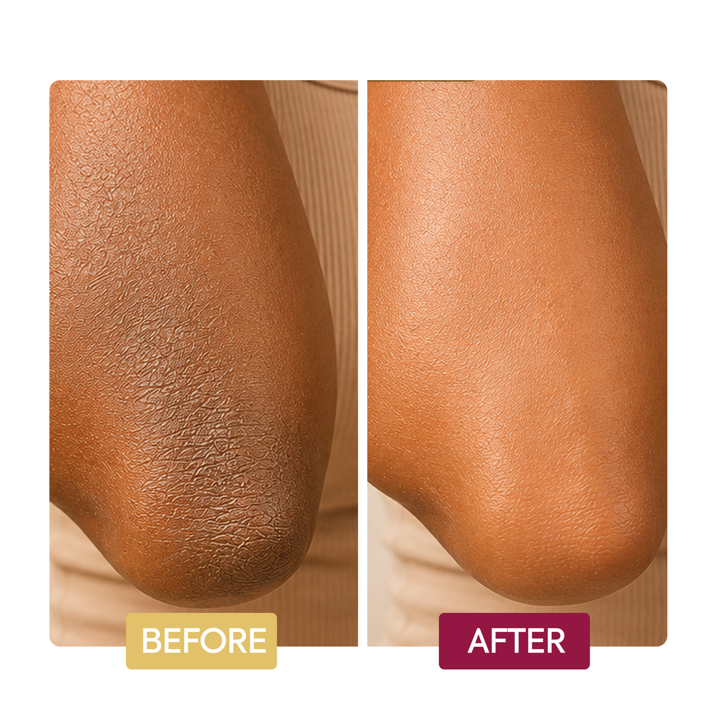 Clarifying Cream Hand, Foot & Elbow - Image 4