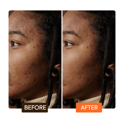 Extreme Argan & Carrot Oil Dark Spot Corrector Serum - Image 6