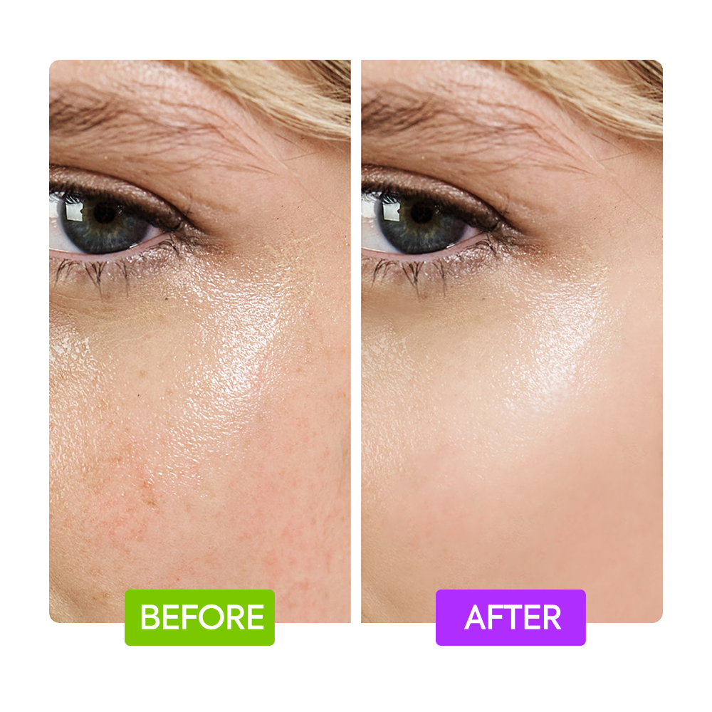 20% Aha + 10% Niacinamide Booster - IYKYK - Image 5