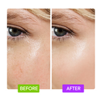 20% Aha + 10% Niacinamide Booster - IYKYK - Image 5