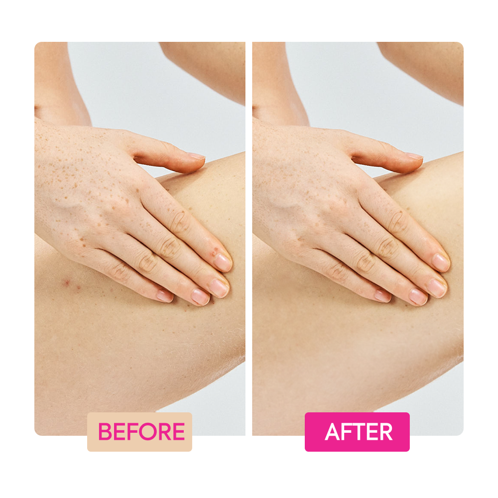 Ginger Extract + Tranexamic Acid + Retinol Body Toning Cream - IYKYK - Image 5