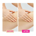 Ginger Extract + Tranexamic Acid + Retinol Body Toning Cream - IYKYK - Image 5